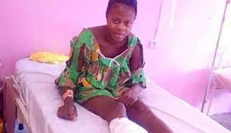 Au Cameroun, un homme coupe une jambe à sa femme à cause de ses restes de spaghettis