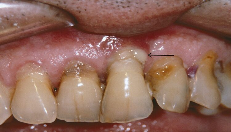 mâchoire humaine imbibée de sang Ph Merc manual