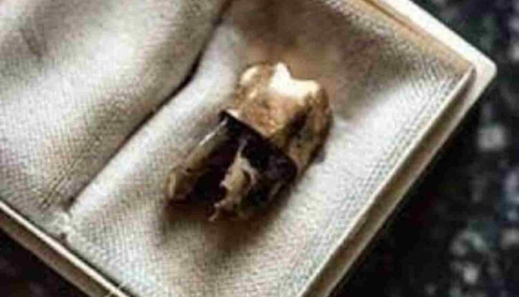 La dent de Patrice Lumumba enfin restituée à la RDC