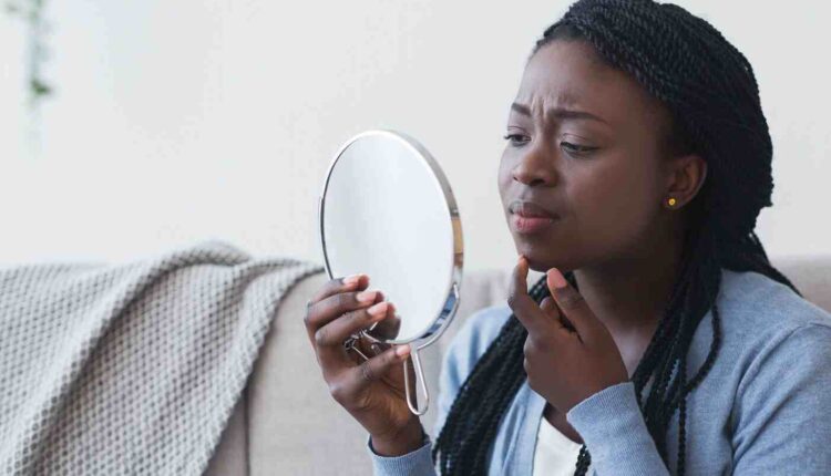 barbes au menton de la femme ph Grazia