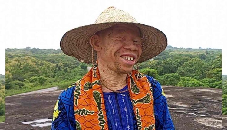 Houètèhou Franck Hounsa raconte son échec au BAC